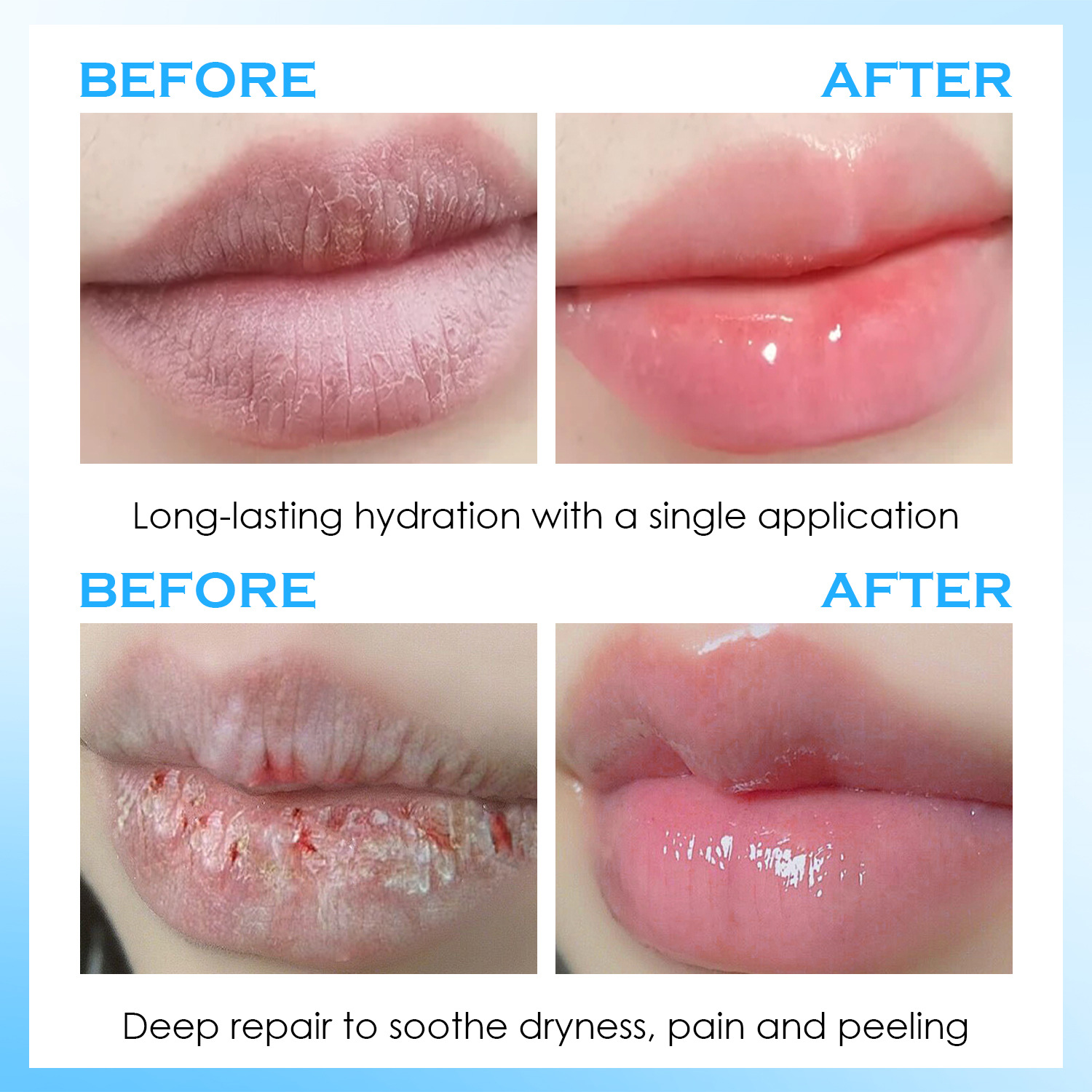 リップセラム、保湿バーム、高保湿リップケア、唇のシワを目立た - Lip Balm のレビューと価格