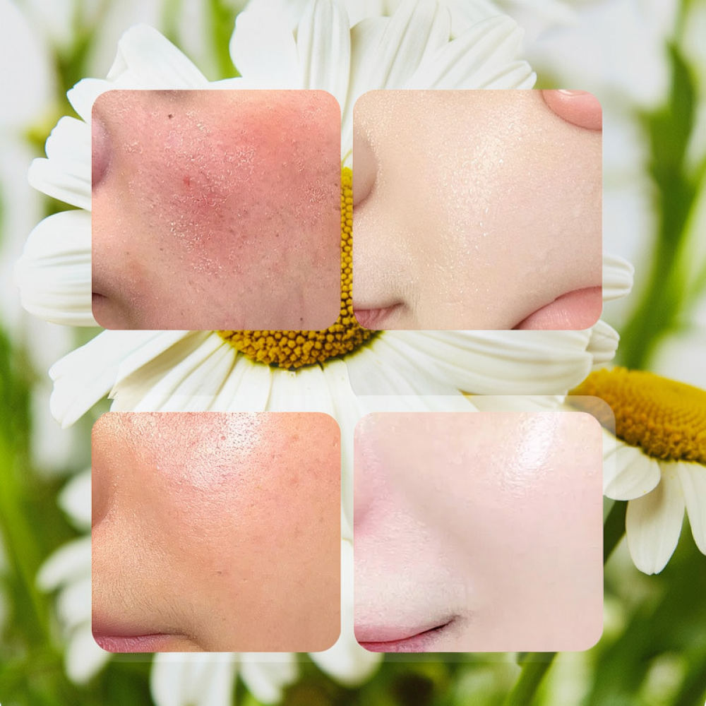 Fykly ローズVC カモミール B5 ビタミン配合 フェ - Face Mask Skincare のレビューと価格